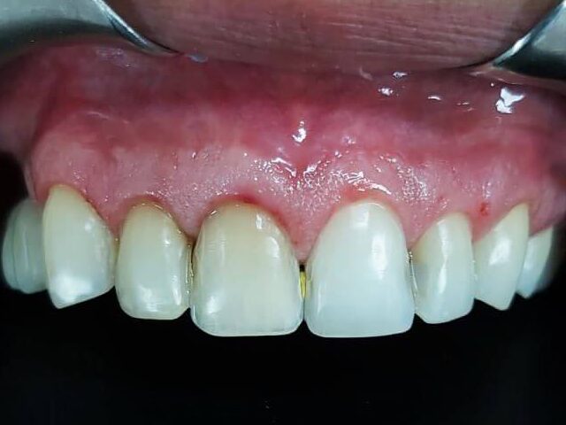 Dientes con diferentes colores, formas inadecuadas